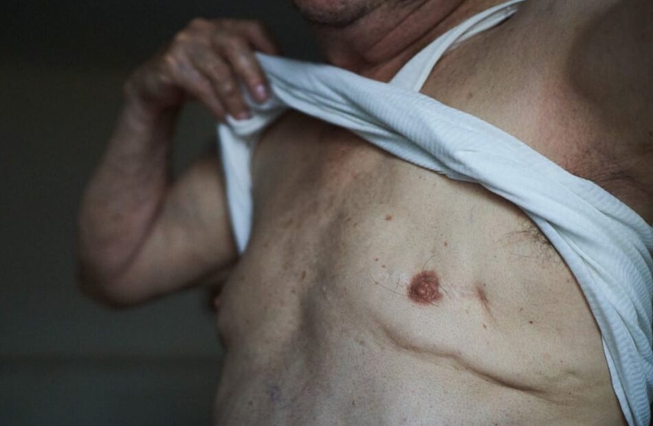 El juzgado de Huércal Overa investiga al SAS por la muerte de un hombre de Garrucha con cáncer de mama